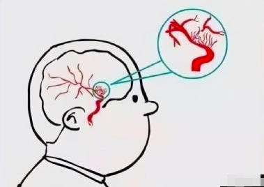 Snipaste_2024 02 18_12 02 12.png王虎應六爻占同事突然腦溢血吉凶