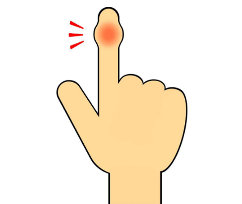 王虎應六爻注意手受傷 王虎應六爻注意手受傷